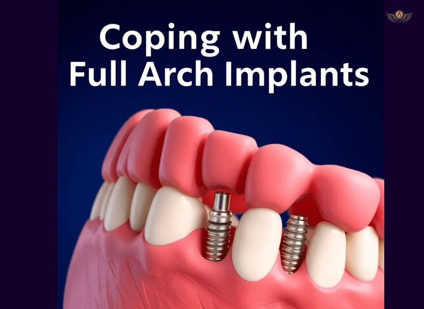 Coping with Full Arch Dental Implants: A Comprehensive Guide \