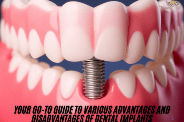 Your go-to guide to various advantages and disadvantages of dental implants