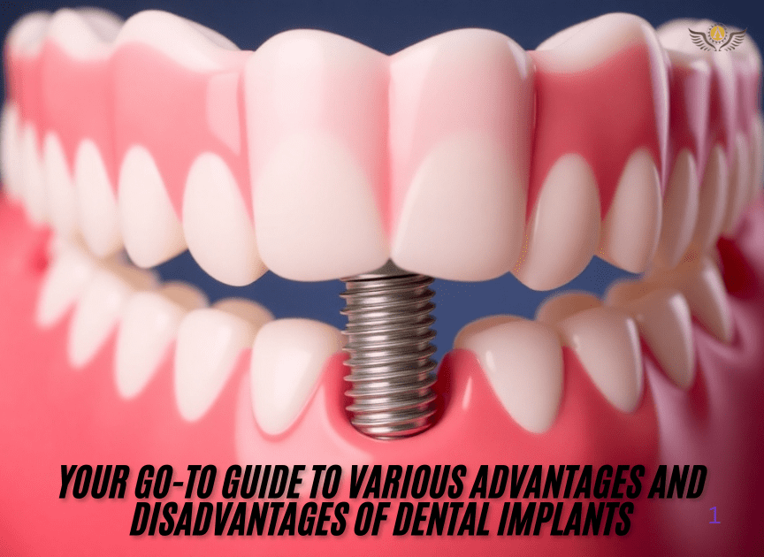 Your go-to guide to various advantages and disadvantages of dental implants