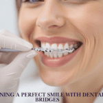 Gaining A Perfect Smile With Dental Bridges