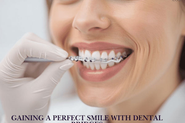 Gaining A Perfect Smile With Dental Bridges