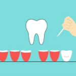 A General Dentist's Approach To Managing Toothaches