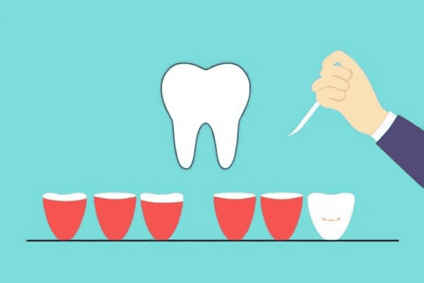 A General Dentist's Approach To Managing Toothaches